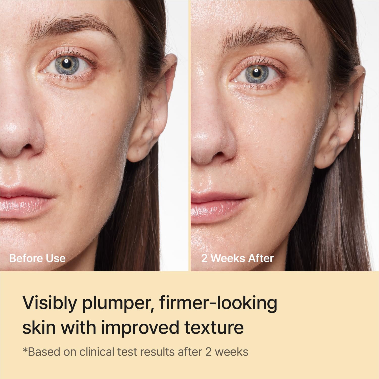 REJURAN® Turnover Ampoule Korean Skin Care