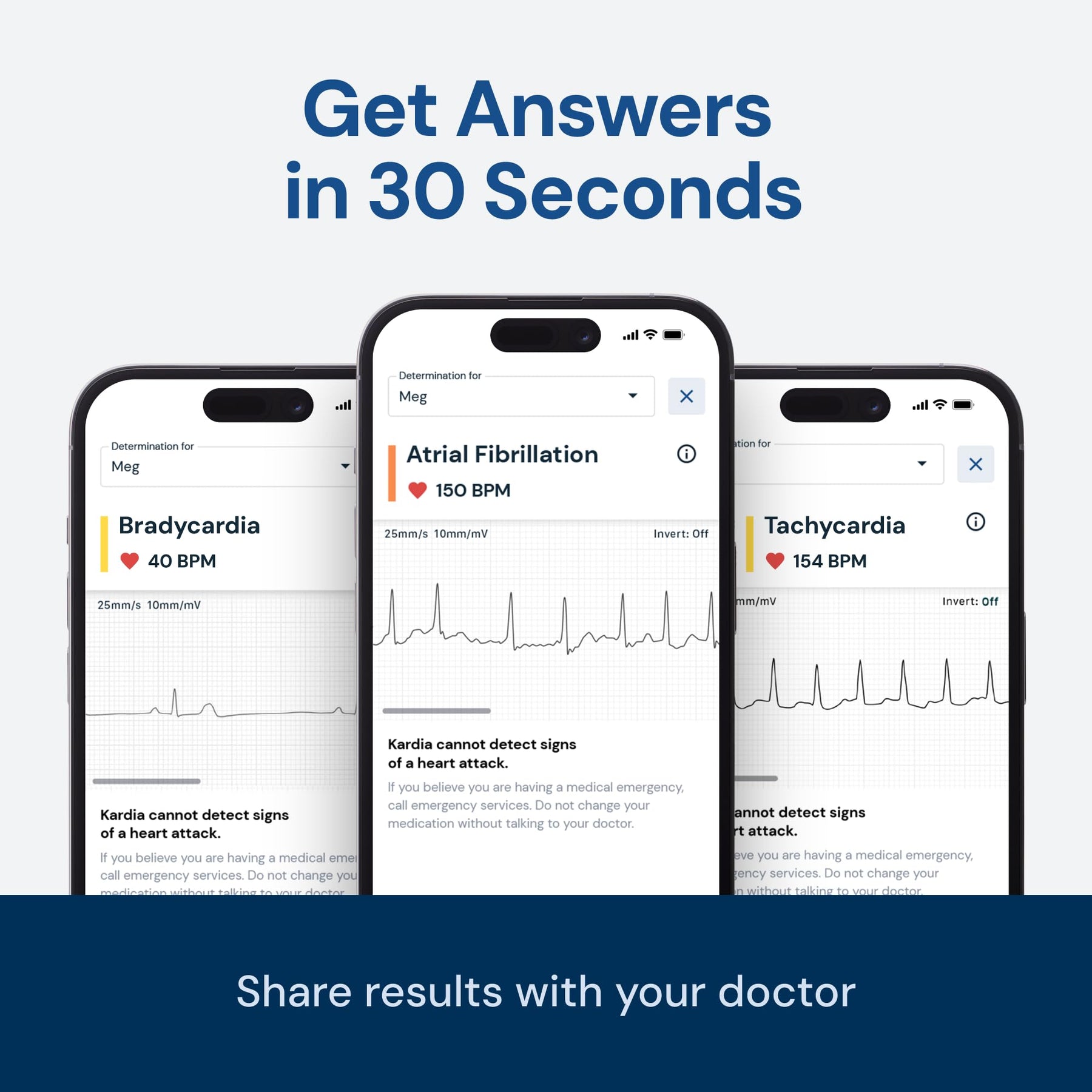 Personal EKG Heart Monitor