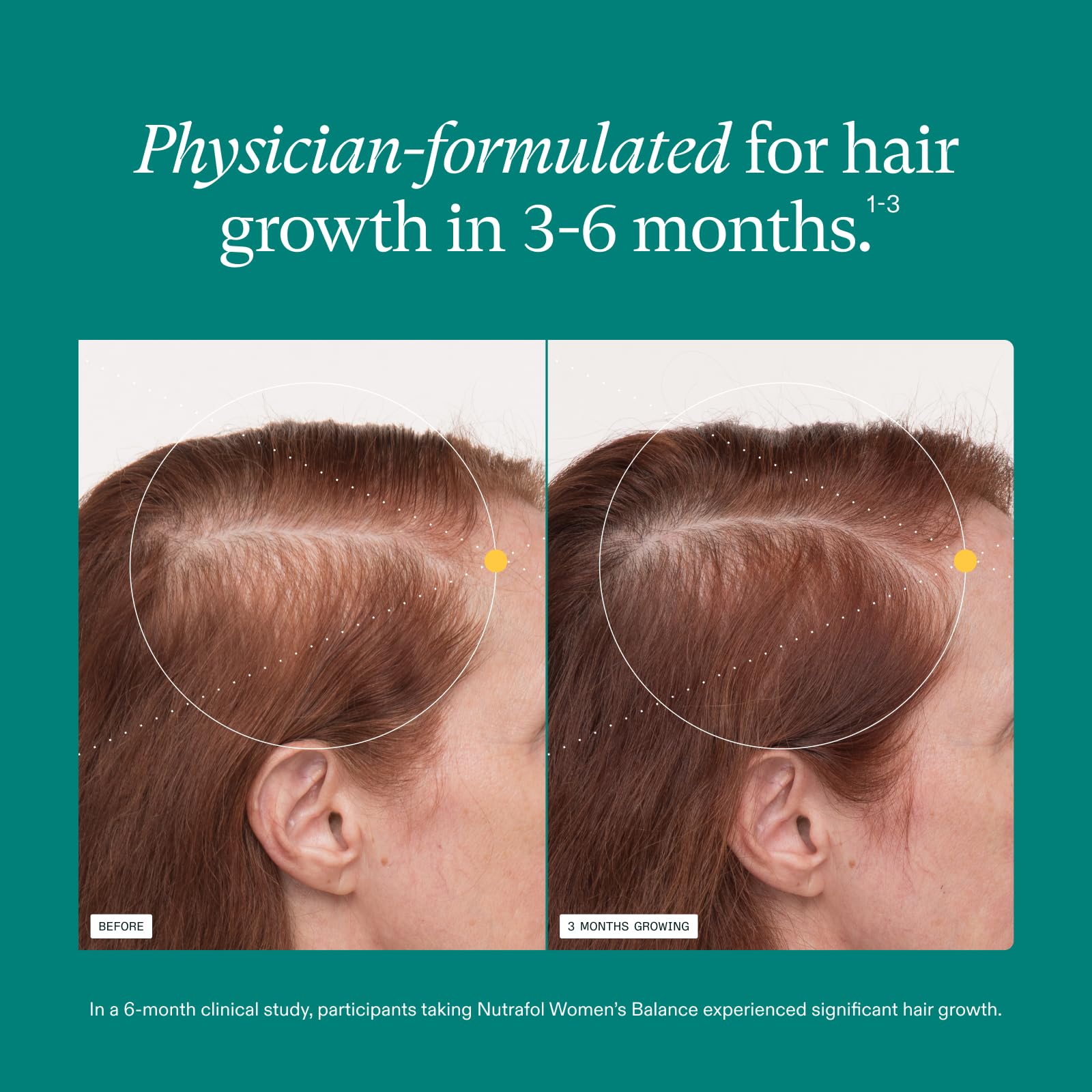 Women's Hair Growth Supplements 45+