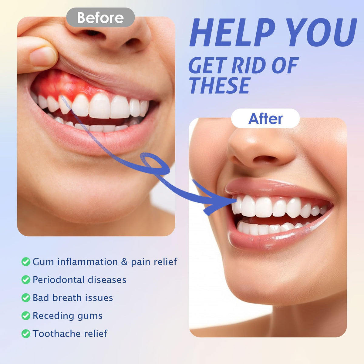 LED Red Light Therapy for Gums