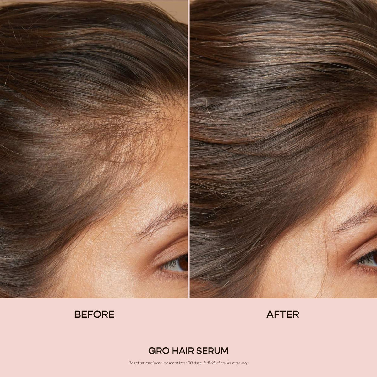 Hair Growth Serum for Thinning Hair