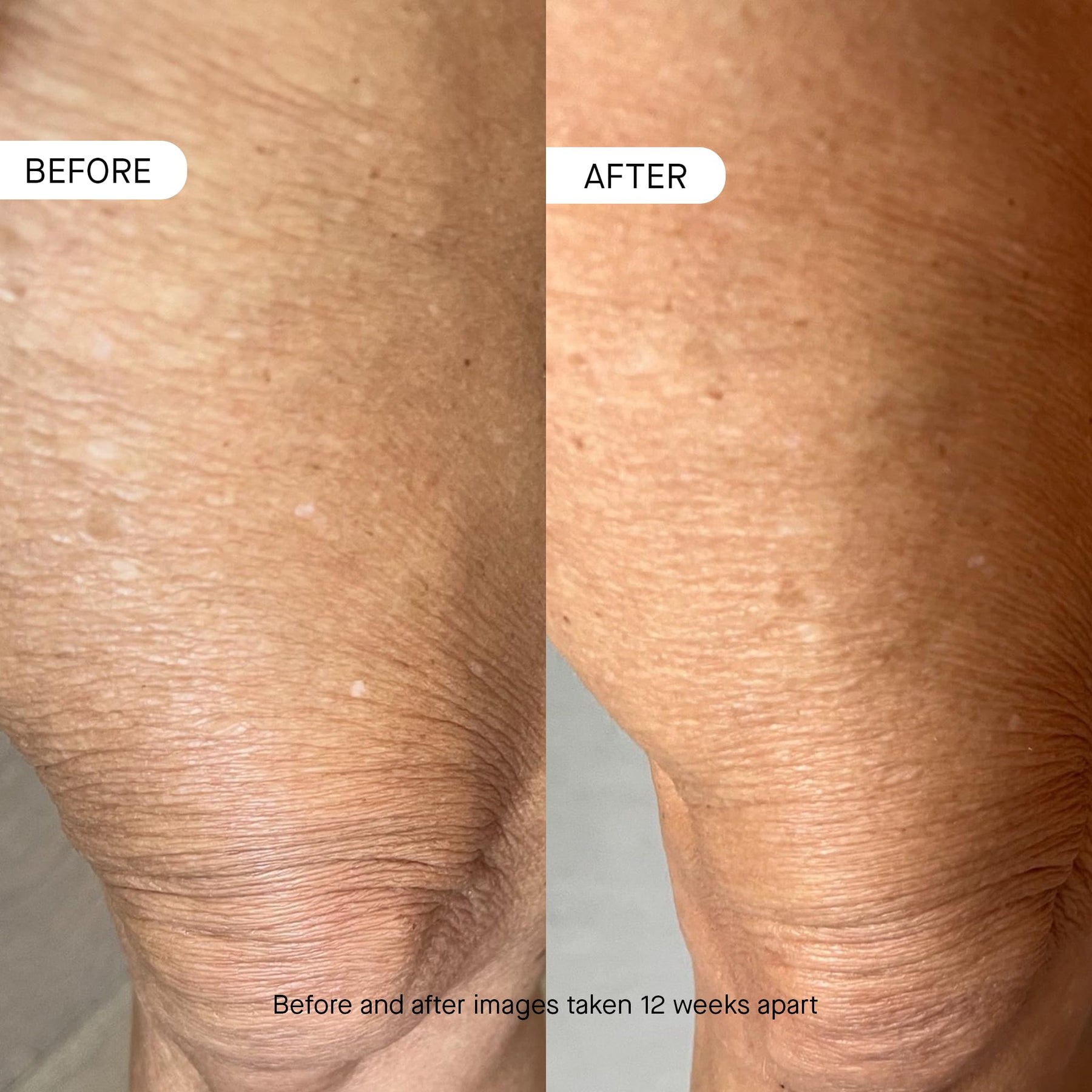 Peptide Body Moisturizer