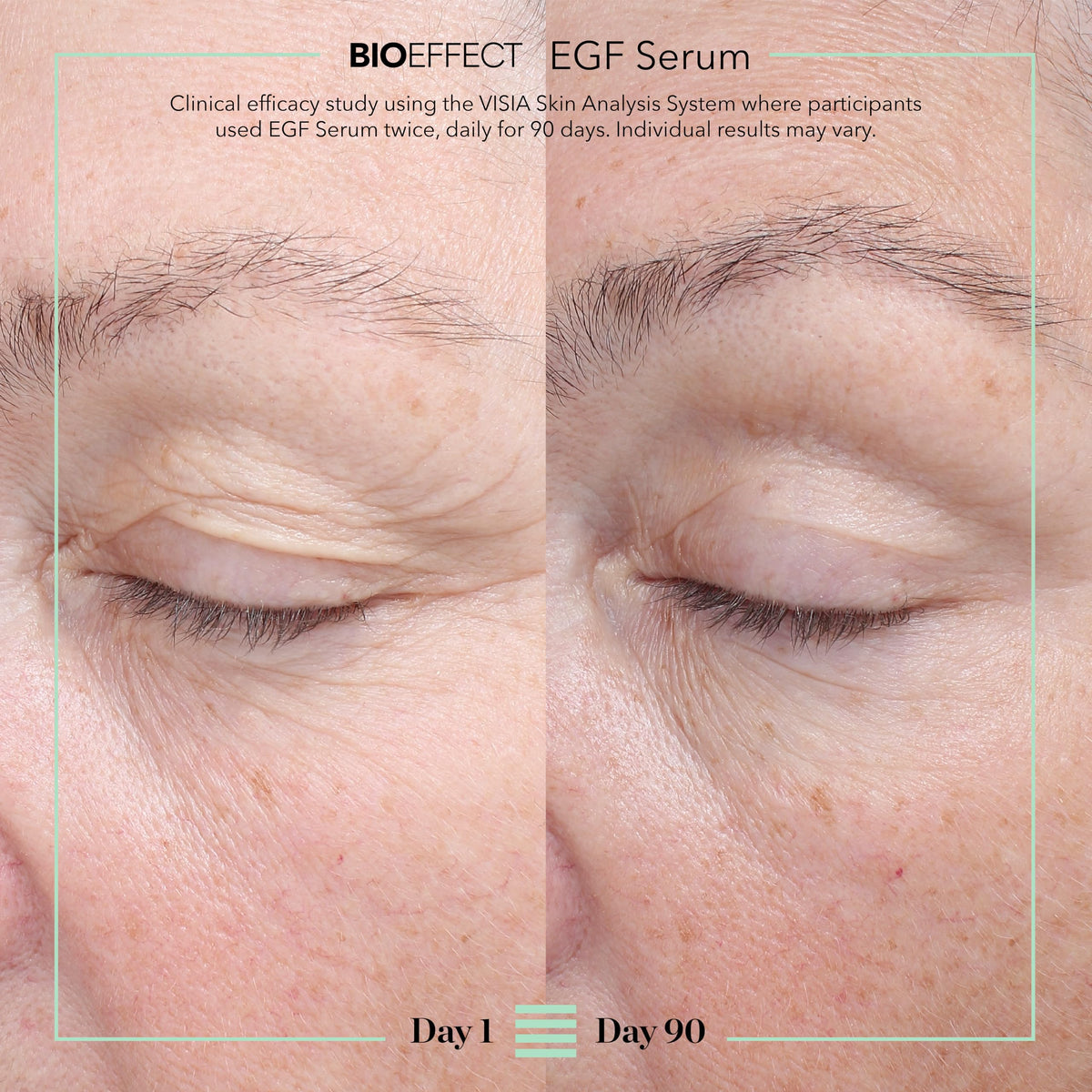 EGF Hyaluronic Acid Face Serum